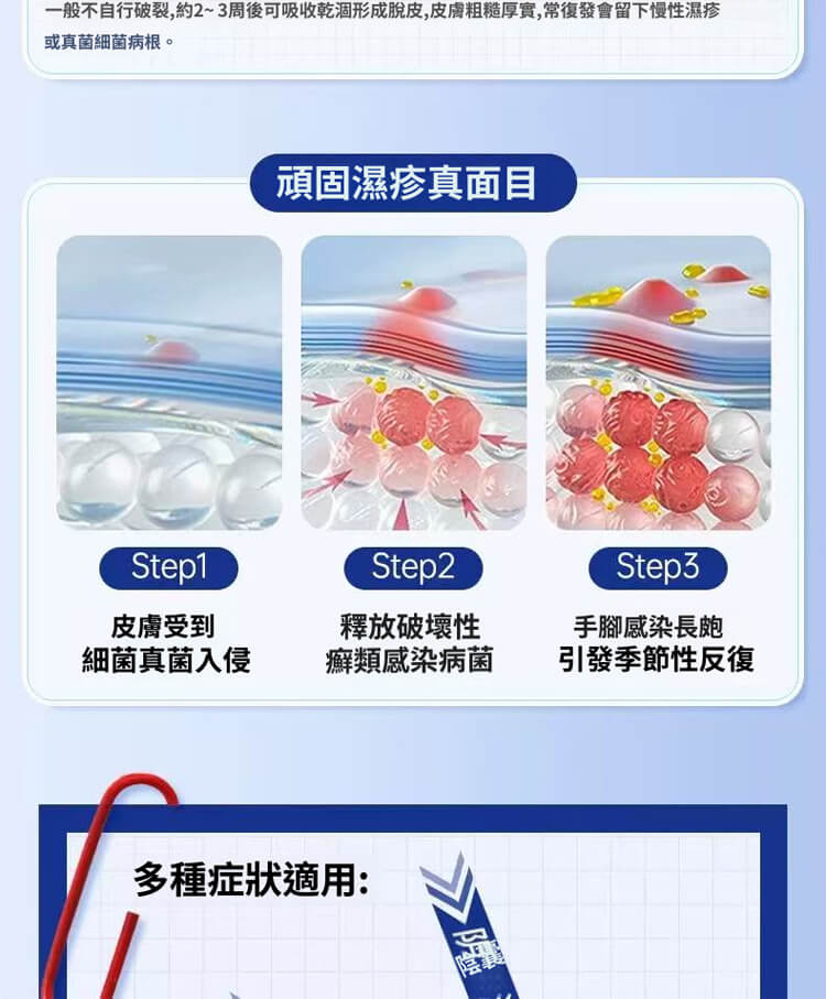 舒克炎抑菌乳膏 舒克炎抑菌乳膏