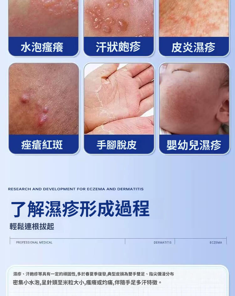 舒克炎抑菌乳膏 舒克炎抑菌乳膏