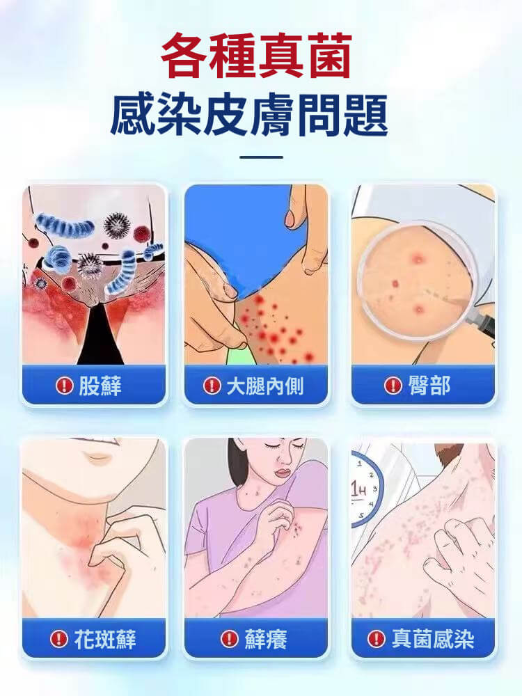 舒克炎抑菌乳膏 舒克炎抑菌乳膏
