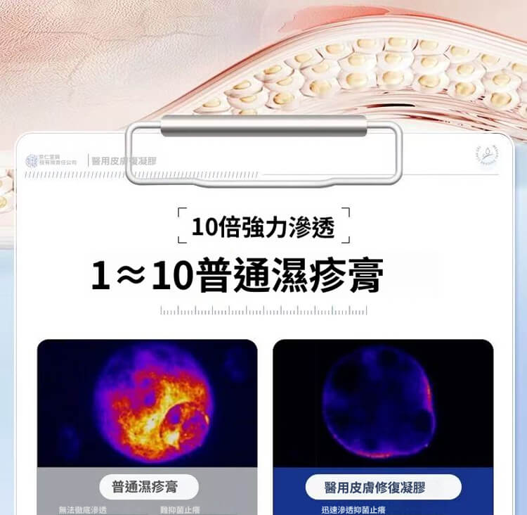 舒克炎抑菌乳膏 舒克炎抑菌乳膏