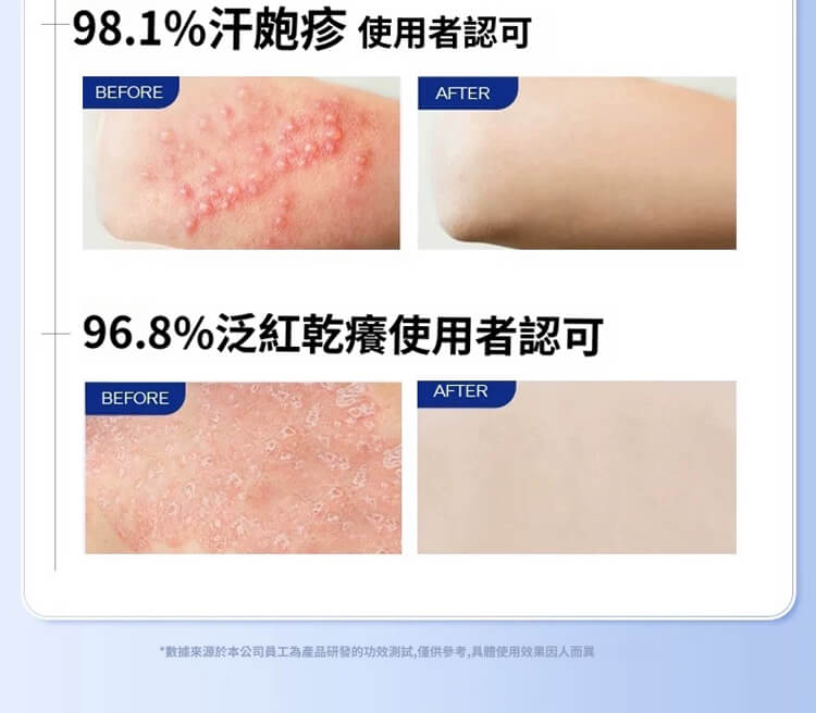 舒克炎抑菌乳膏 舒克炎抑菌乳膏